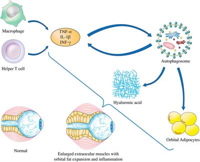 Autophagy in graves’ ophthalmopathy